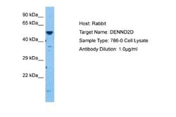 DENN/MADD Domain Containing 2D Rabbit anti-Human, Polyclonal, Novus Biologicals